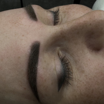 Заживши стрілка через 2роки.Поновлення брів 
  