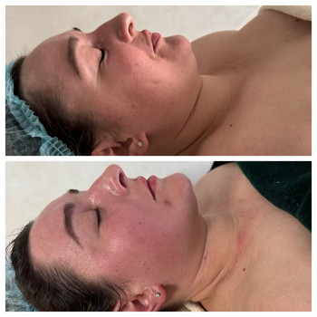 Олена Захарченко, Одеса Фото - 39