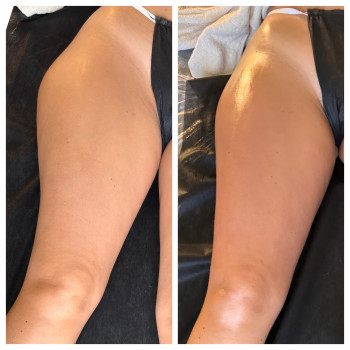 Олена Захарченко, Одеса Фото - 40