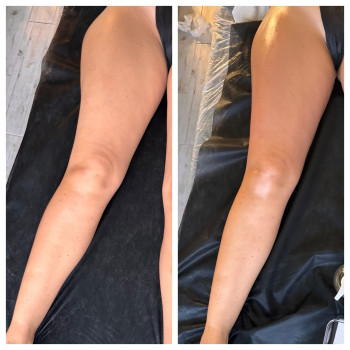 Олена Захарченко, Одеса Фото - 41