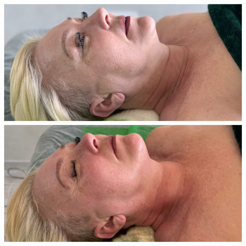 Олена Захарченко, Одеса Фото - 42