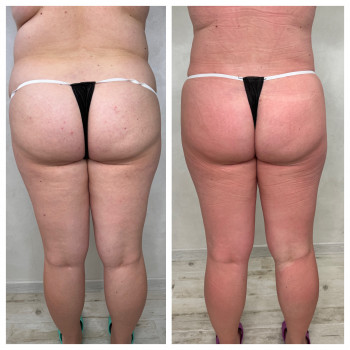 Олена Захарченко, Одеса Фото - 43