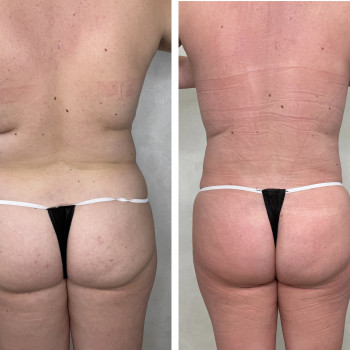 Олена Захарченко, Одеса Фото - 44