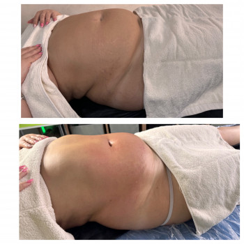 Олена Захарченко, Одеса Фото - 45