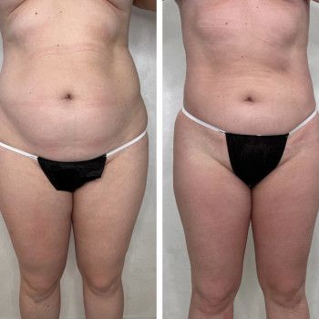 Ручная пластика
                    Массажист Елена Одесса