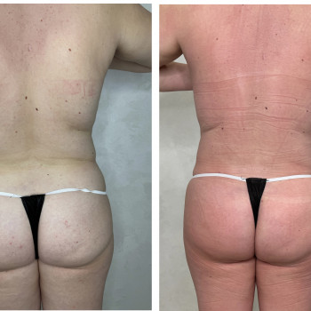 Ручная пластика
                    Массажист Елена Одесса