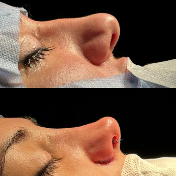 Абдель Эрритали, Харків Фото - 4