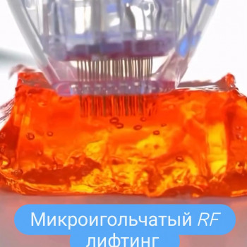 Мікроігольчастий RF-ліфтинг
                    Косметолог Дарья Одесса
