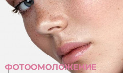 ipl фотоомоложение Косметолог Дарья Одеса