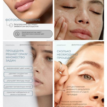 ipl фотоомоложение
                    Косметолог Дарья Одесса