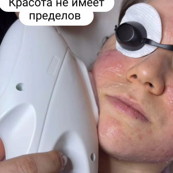 ipl фотоомоложение
                    Косметолог Дарья Одесса