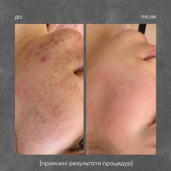 ipl фотоомоложение
                    Косметолог Дарья Одесса