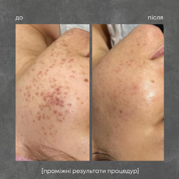 ipl фотоомоложение
                    Косметолог Дарья Одесса