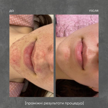 ipl фотоомоложение
                    Косметолог Дарья Одесса