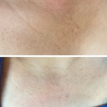 ipl фотоомоложение
                    Косметолог Дарья Одесса