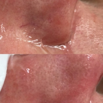 ipl фотоомоложение
                    Косметолог Дарья Одесса