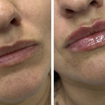 Яна Владимирова, Черкассы Фото - 24