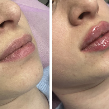 Яна Владимирова, Черкассы Фото - 17