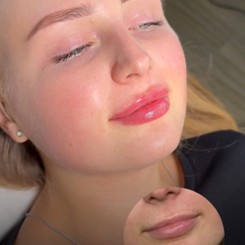 Альона Бордачова, Суми Фото - 2