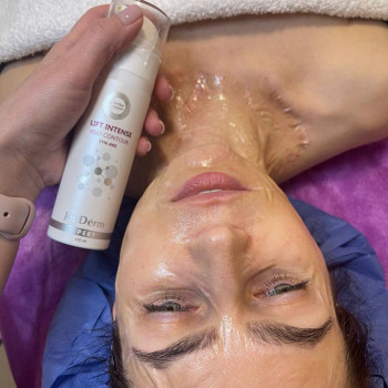 Ферментна терапія
                    Косметолог-инъекционист Євгенія Ивано-Франковск