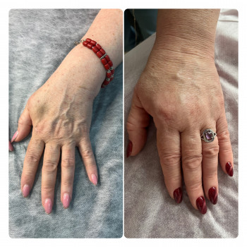 Натали Ткаченко, Киев Фото - 7