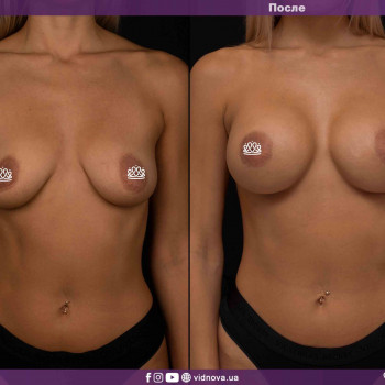 Фото з портфоліо фахівця Світлана Работенко (пластичний хірург, Львів)