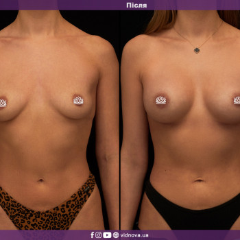 Фото з портфоліо фахівця Світлана Работенко (пластичний хірург, Львів)