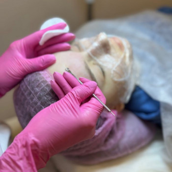 Комбінована чистка обличчя
                    Косметолог-ін'єкціоніст Марьяна Фастів