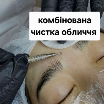 Комбінована чистка обличчя
                    Косметолог-ін'єкціоніст Марьяна Фастів