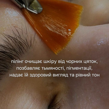 Пілінг
                    Косметолог-инъекционист Марьяна Фастов