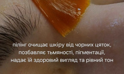 Пілінг Косметолог-ін'єкціоніст Марьяна Фастів