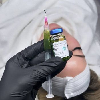 Пілінг
                    Косметолог-инъекционист Марьяна Фастов