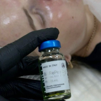 Пілінг
                    Косметолог-инъекционист Марьяна Фастов