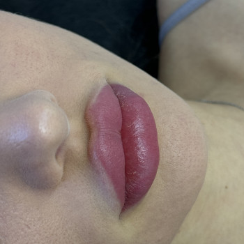 Загоєні губи