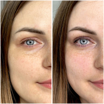 Людмила Грицай, Київ Фото - 3