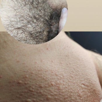 Олена Куксіна, Сумы Фото - 6