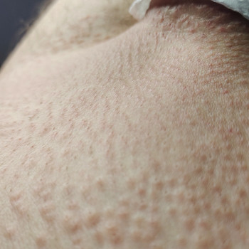 Олена Куксіна, Сумы Фото - 8