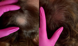 Трихопігментація Мастер перманентного макияжа Наталия Ивановна Киев