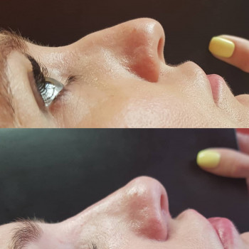 Фото з портфоліо косметолога Віра Петрівна (Черкаси)