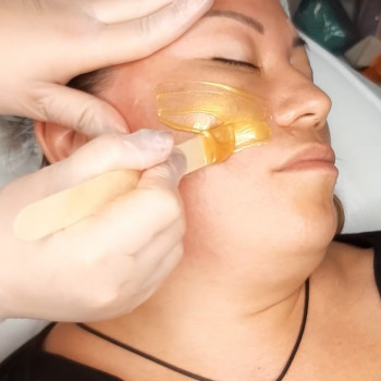 Депіляція обличчя: 100 грн 1 зона, чи 400 грн обличчя цілком