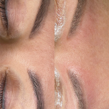 Лазерне видалення  неякісно татуажу та тату
                    Майстер перманентного макіяжу Ганна Київ