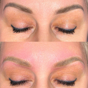 Лазерне видалення  неякісно татуажу та тату
                    Майстер перманентного макіяжу Ганна Київ