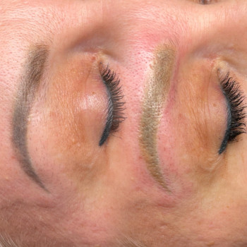 Лазерне видалення  неякісно татуажу та тату
                    Майстер перманентного макіяжу Ганна Київ