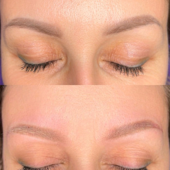 Лазерне видалення татуажу
                    Мастер перманентного макияжа Ганна Киев