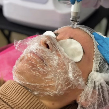 Анжеліка Лозко, Луцк Фото - 8