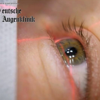 Немецкая глазная клиника, Киев Фото - 5