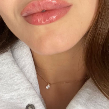 Збільшення губ
                    Косметолог Анна Вінниця