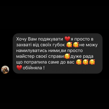 Збільшення губ
                    Косметолог Анна Вінниця