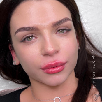 Збільшення губ
                    Косметолог Анна Вінниця