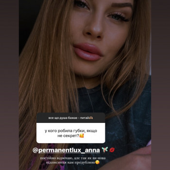 Збільшення губ
                    Косметолог Анна Вінниця